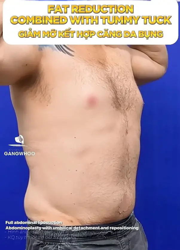 hut mo bung