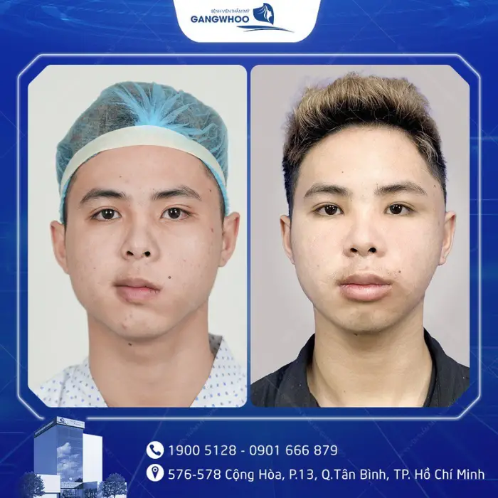 liet mat