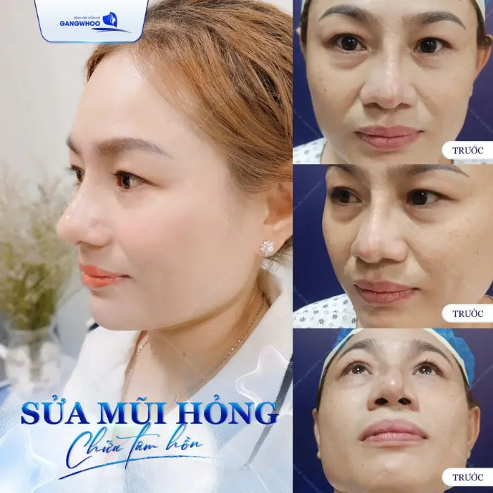 mui hong 4