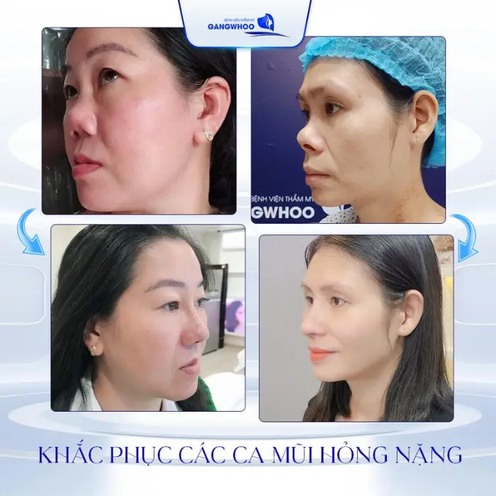 mui hong 6