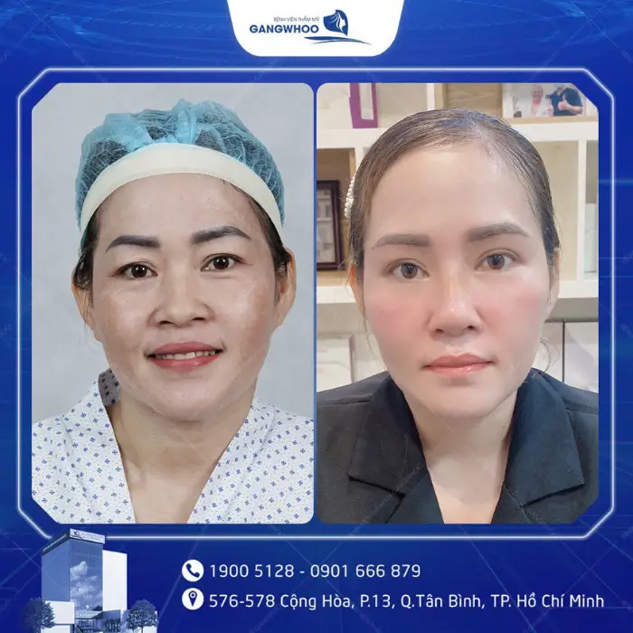 nang cung chan may 1