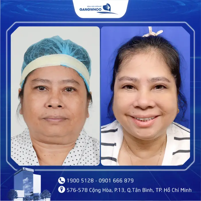 nang cung chan may 2