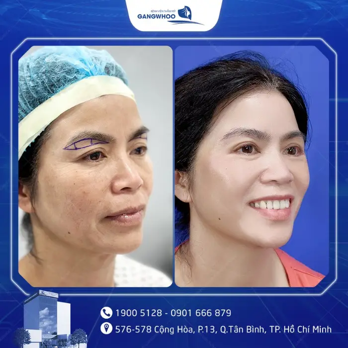 nang cung chan may 5