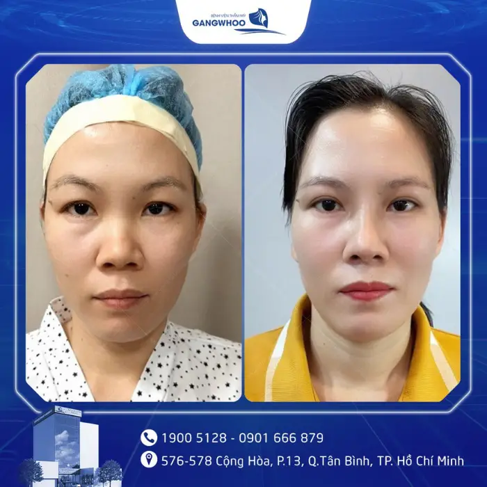 nang cung chan may 6