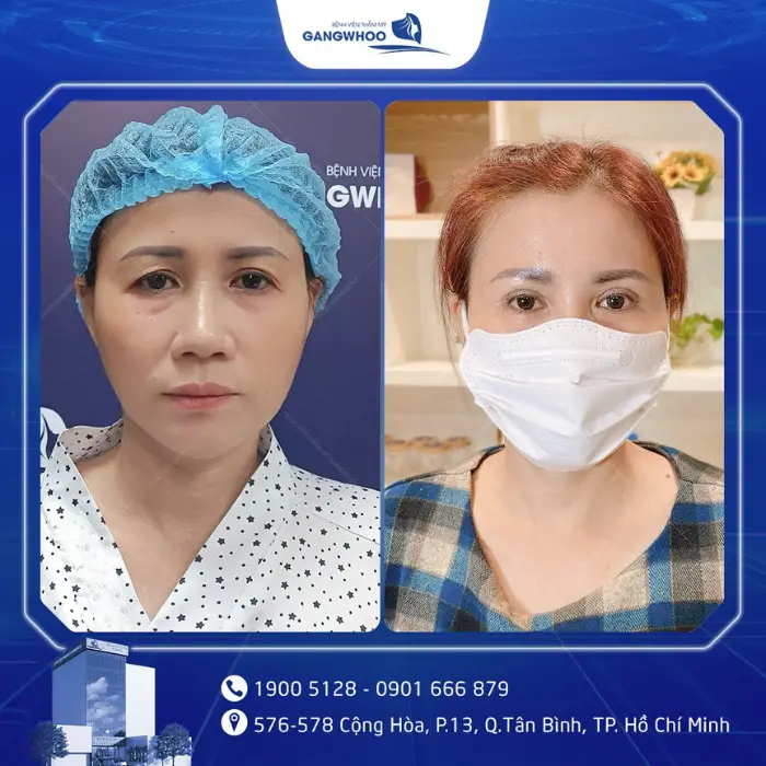 nang cung chan may 7