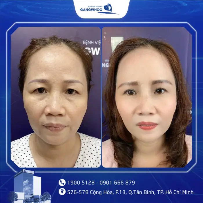nang cung chan may