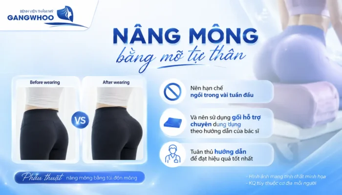 Nâng Mông Bao Lâu Thì Ngồi Được? Thời Gian Hồi Phục Chuẩn Y Khoa