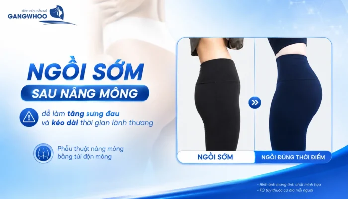 Nâng Mông Bao Lâu Thì Ngồi Được? Thời Gian Hồi Phục Chuẩn Y Khoa