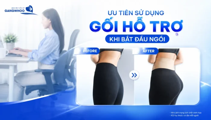 Nâng Mông Bao Lâu Thì Ngồi Được? Thời Gian Hồi Phục Chuẩn Y Khoa