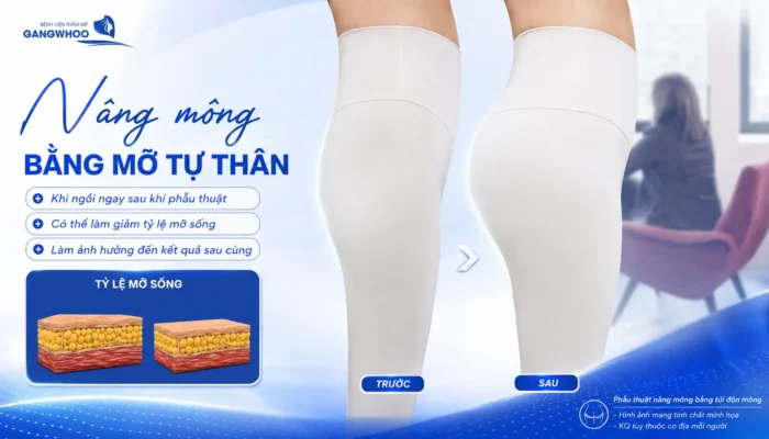 Nâng Mông Bao Lâu Thì Ngồi Được? Thời Gian Hồi Phục Chuẩn Y Khoa