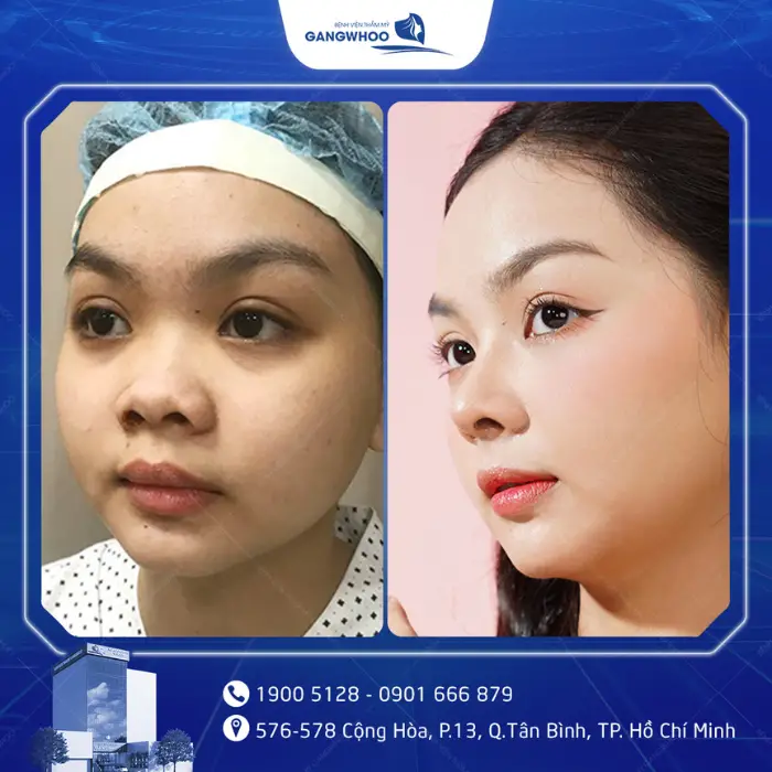 nang mui 10
