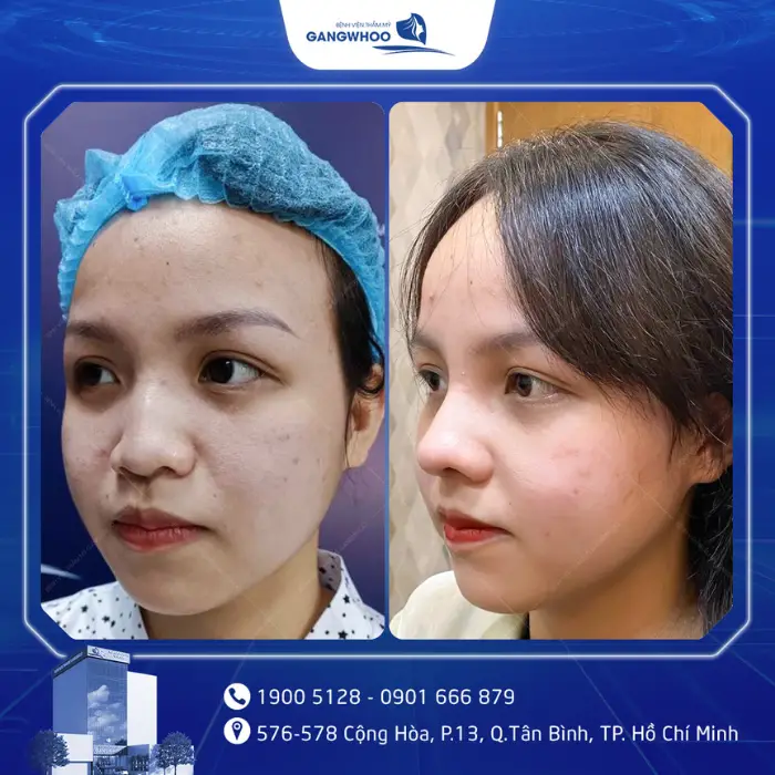 nang mui 12