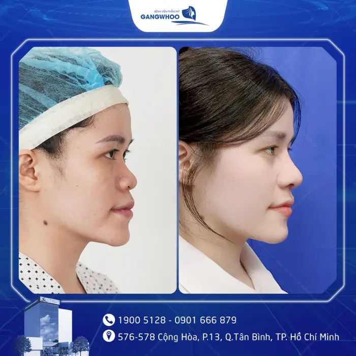 nang mui 15