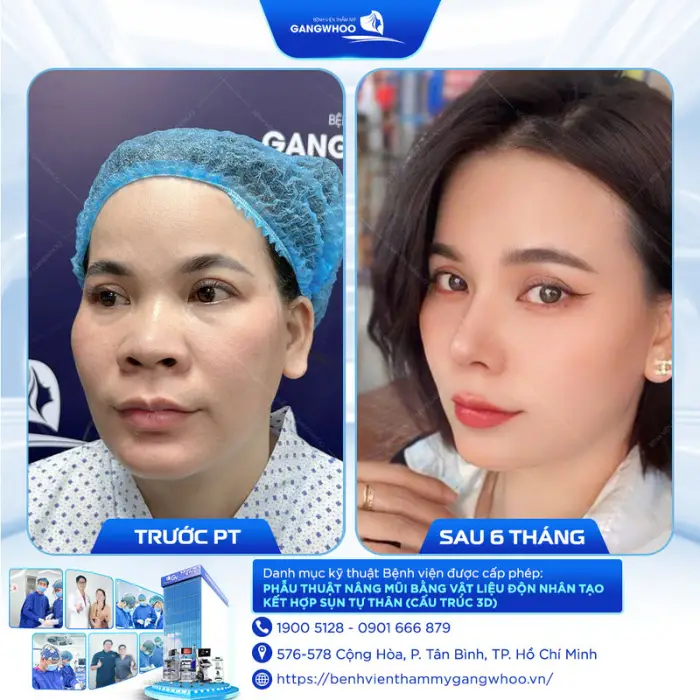 nang mui 20