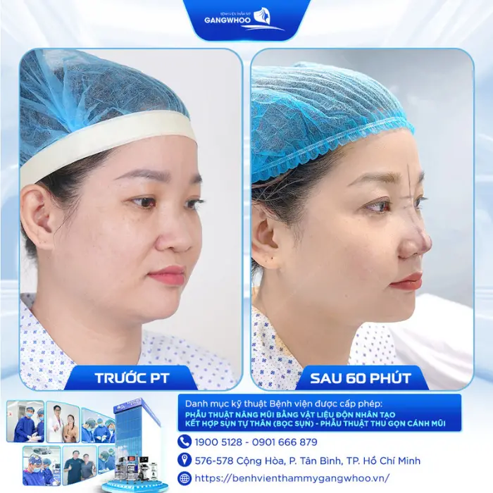 nang mui 21