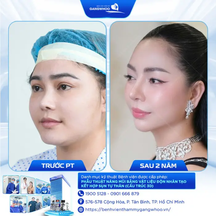 nang mui 22