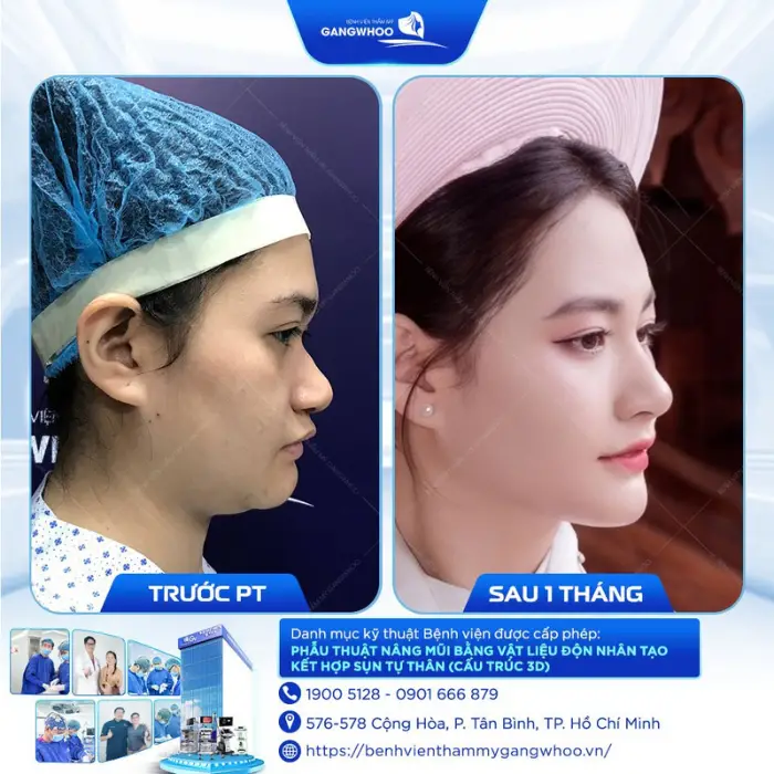 nang mui 24