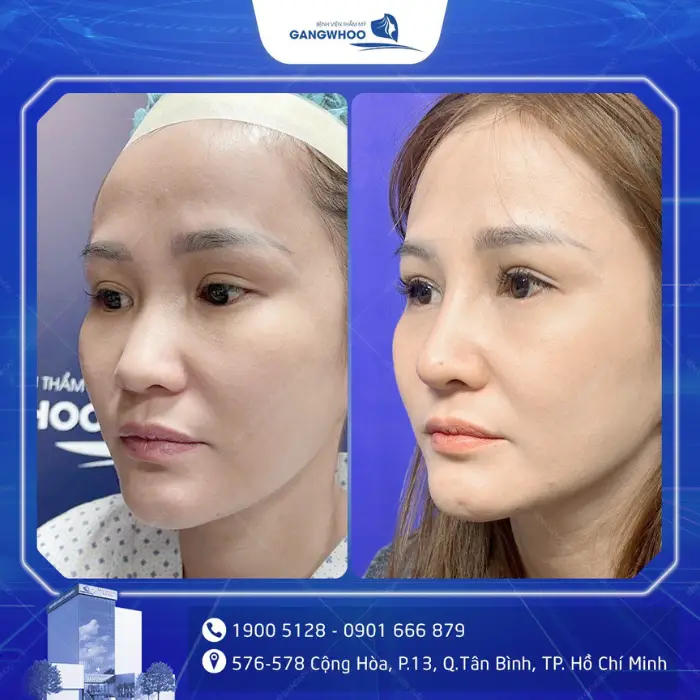 nang mui 30