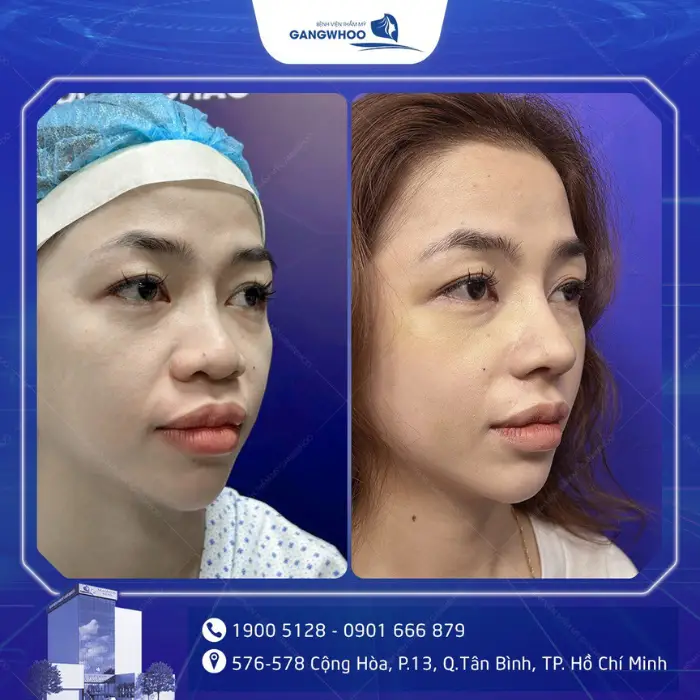 nang mui 31