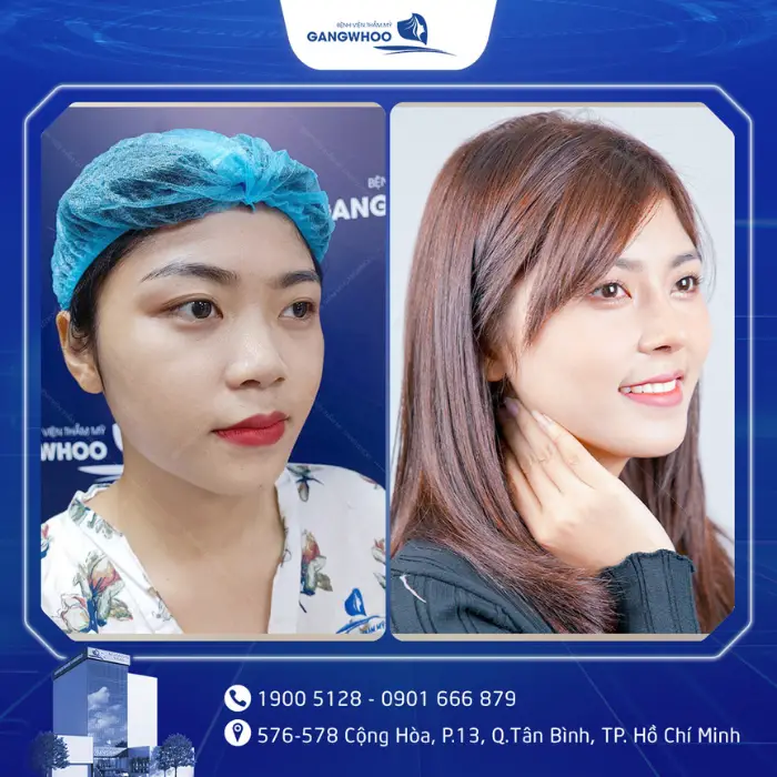 nang mui 6