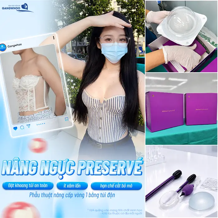 So Sánh Nâng Ngực Tissue Preservation và Preservé: Đâu Là Xu Hướng Nâng Ngực Thế Hệ Mới? 3 So Sánh Nâng Ngực Tissue Preservation và Preservé: Đâu Là Xu Hướng Nâng Ngực Thế Hệ Mới?