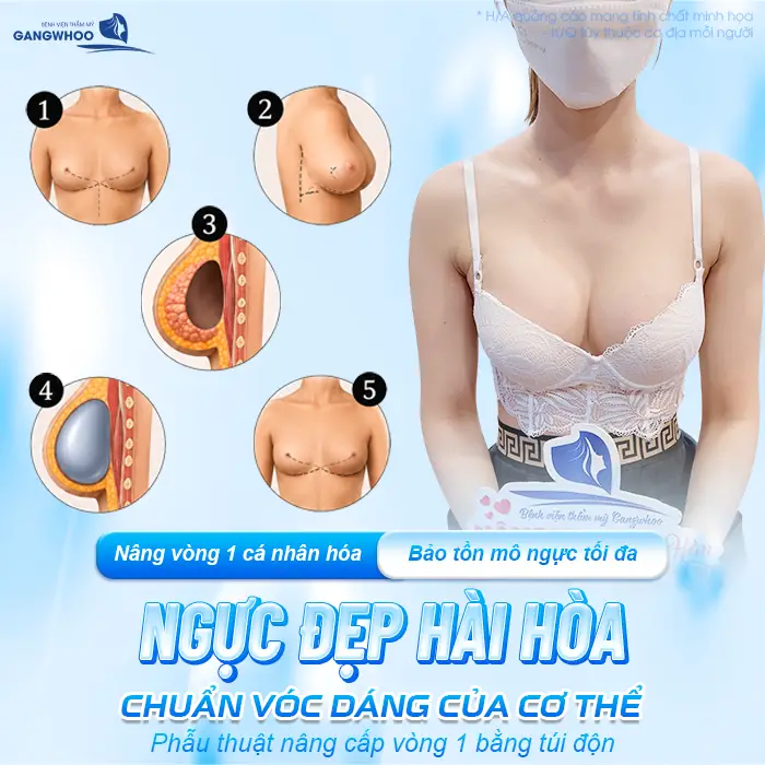 Nâng Ngực Tissue Preservation Là Gì? Tại Sao Là Công Nghệ Bảo Tồn Mô Vú Thế Hệ Mới
