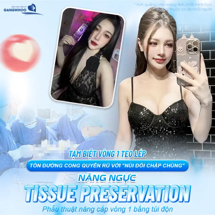 Nâng Ngực Tissue Preservation Là Gì? Tại Sao Là Công Nghệ Bảo Tồn Mô Vú Thế Hệ Mới