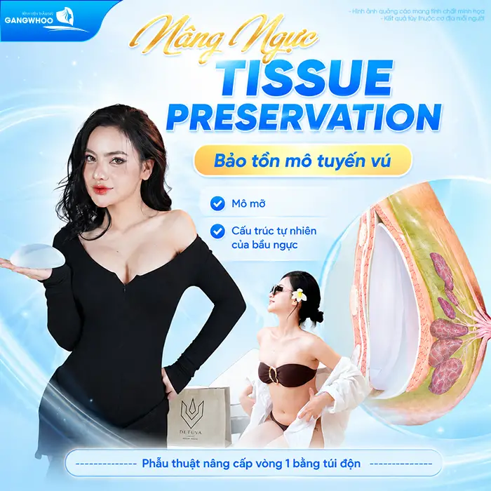 Nâng Ngực Tissue Preservation Là Gì? Tại Sao Là Công Nghệ Bảo Tồn Mô Vú Thế Hệ Mới