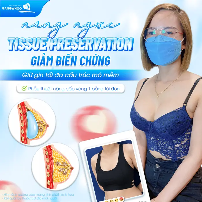 Nâng Ngực Tissue Preservation Là Gì? Tại Sao Là Công Nghệ Bảo Tồn Mô Vú Thế Hệ Mới