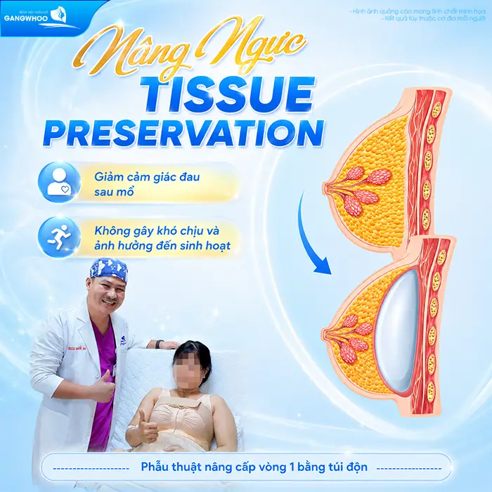 Nâng Ngực Tissue Preservation Là Gì? Tại Sao Là Công Nghệ Bảo Tồn Mô Vú Thế Hệ Mới