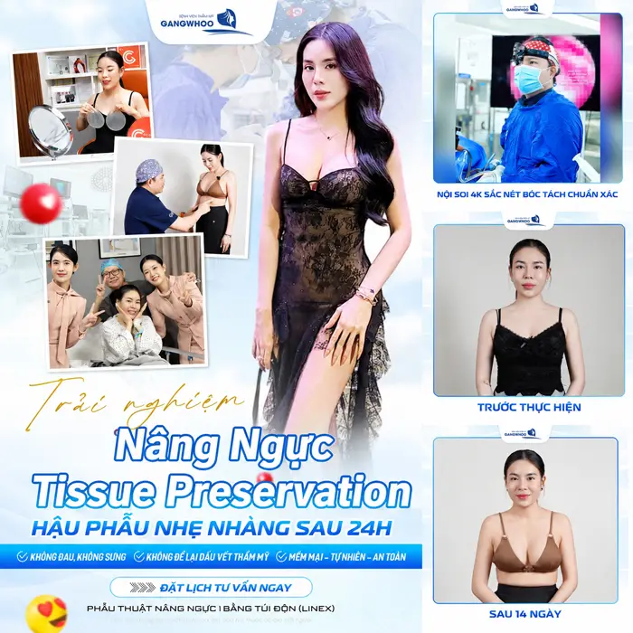 Nâng ngực Tissue Preservation hậu phẫu nhẹ nhàng sau 24h