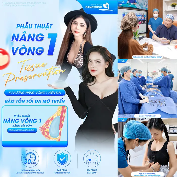 Phẫu thuật nâng vòng 1 Tissue Preservation xu hướng nâng vòng 1 hiện đại bảo tồn mô tuyến 