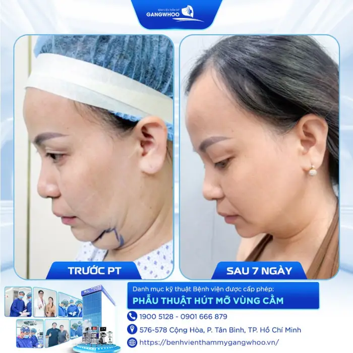nong cam 1