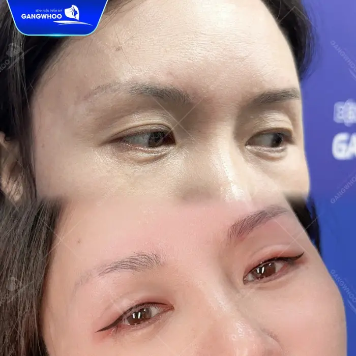phun mi mat