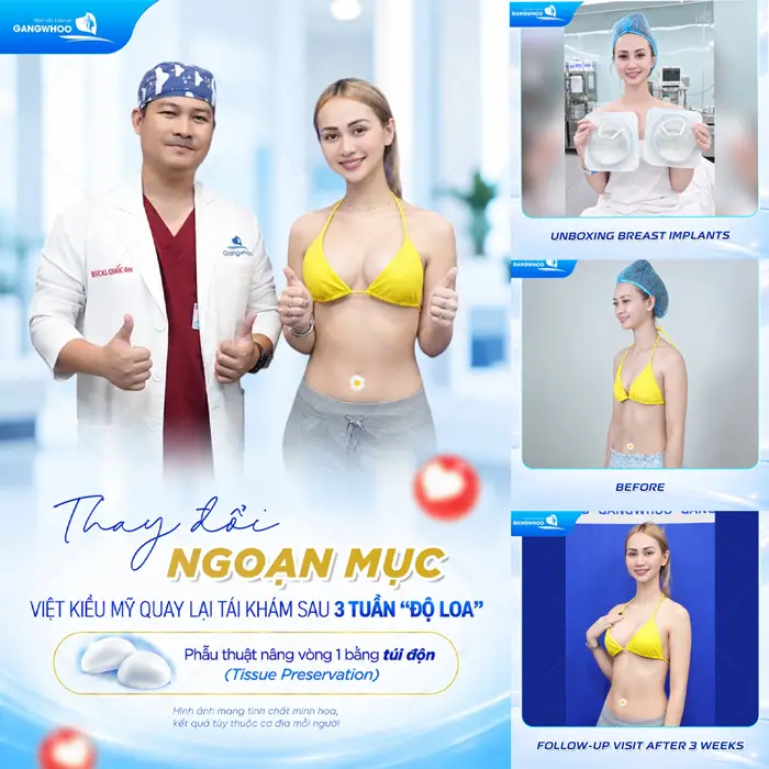 Thay đổi ngoạn mục Việt Kiều Mỹ tái khám sau 3 tuần "nâng vòng 1" tại Gangwhoo tự tin khoe dáng cực nuột nà
