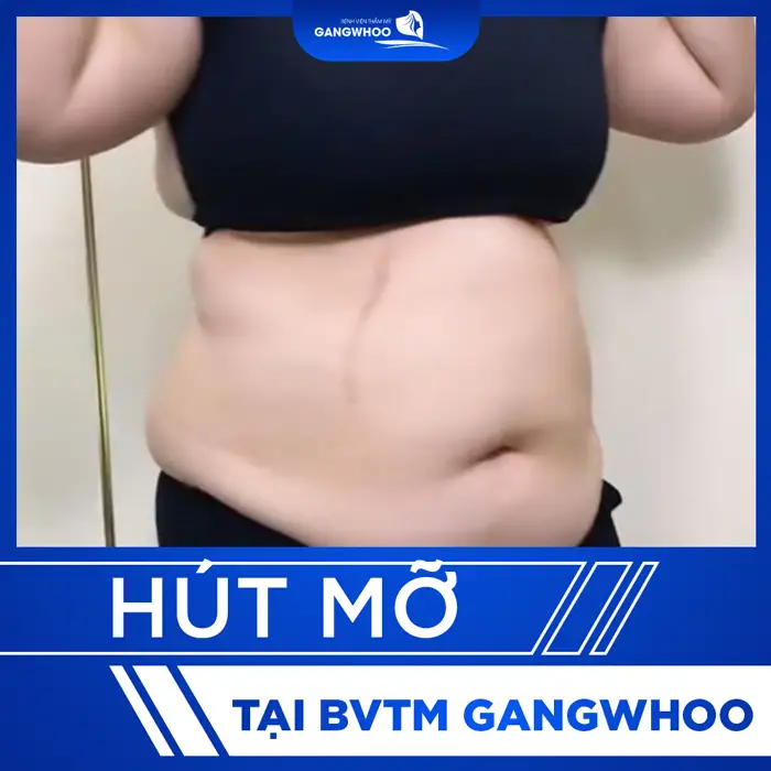 thumb hut mo 2