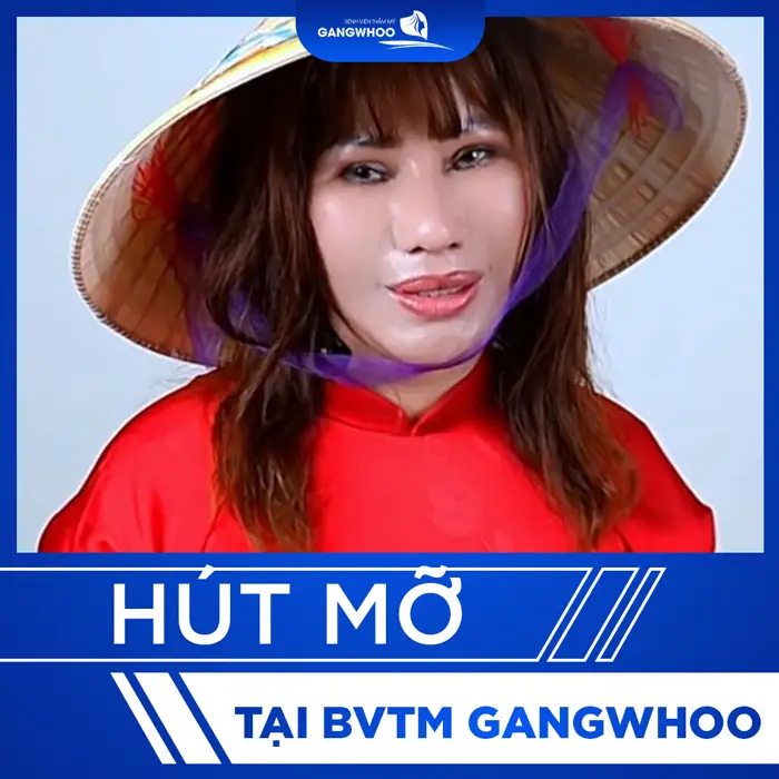 thumb hut mo 7