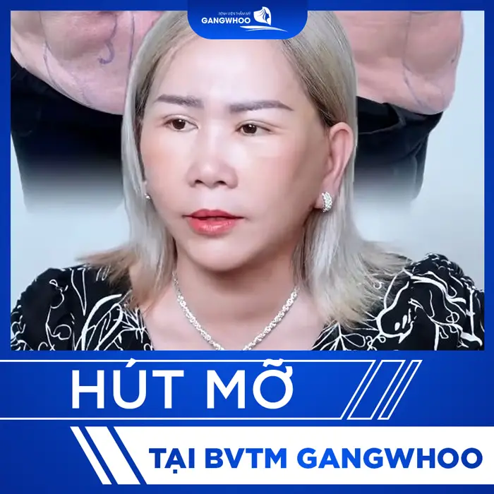 thumb hut mo 8