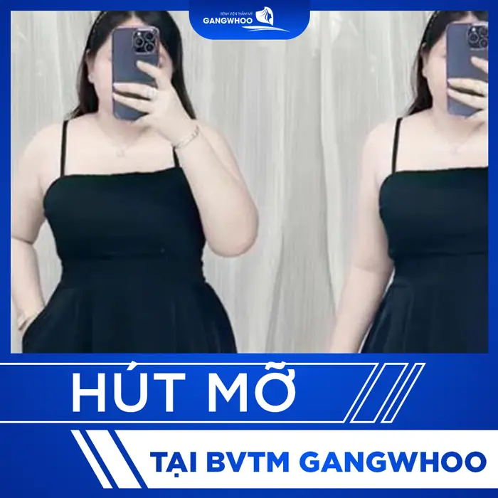 thumb hut mo 9