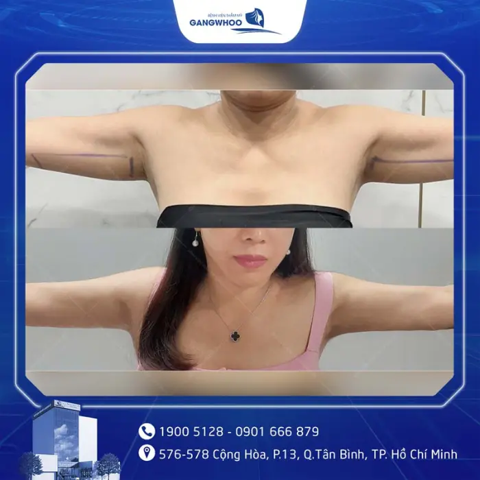 ultrasound tay 10