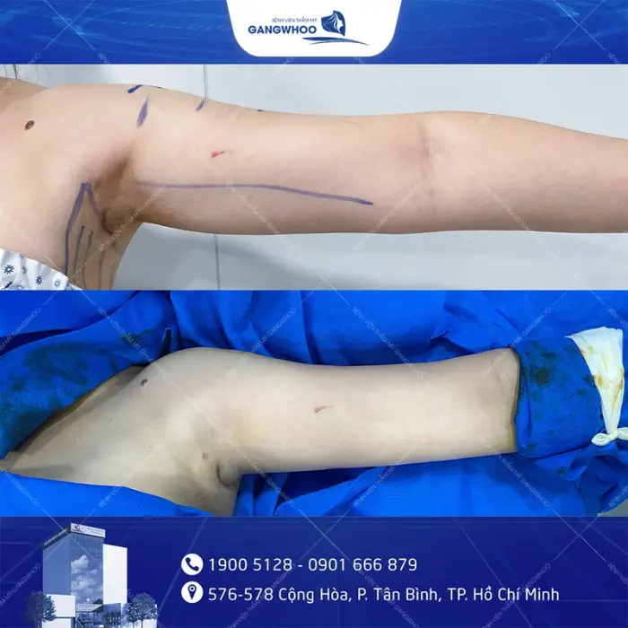 ultrasound tay 4