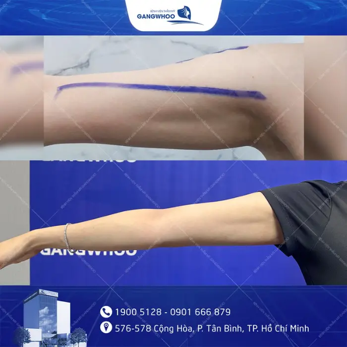 ultrasound tay 7