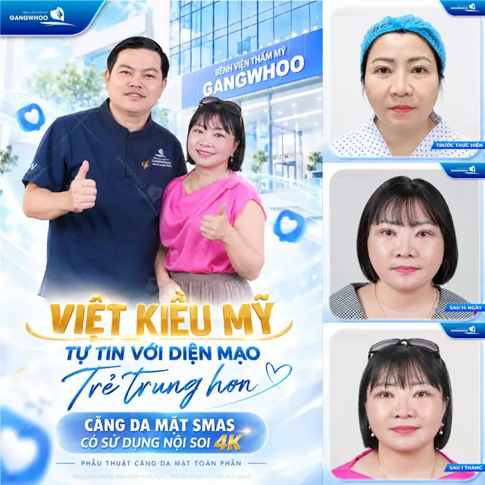 Căng Da Mặt Bị Nhăn Da Sau Tai Có Nguy Hiểm Không? Bác Sĩ Giải Đáp 8 Việt Kiều Mỹ tự tin với diện mạo trẻ trung hơn sau thực hiện căng da mặt có sử dụng nội soi 4K
