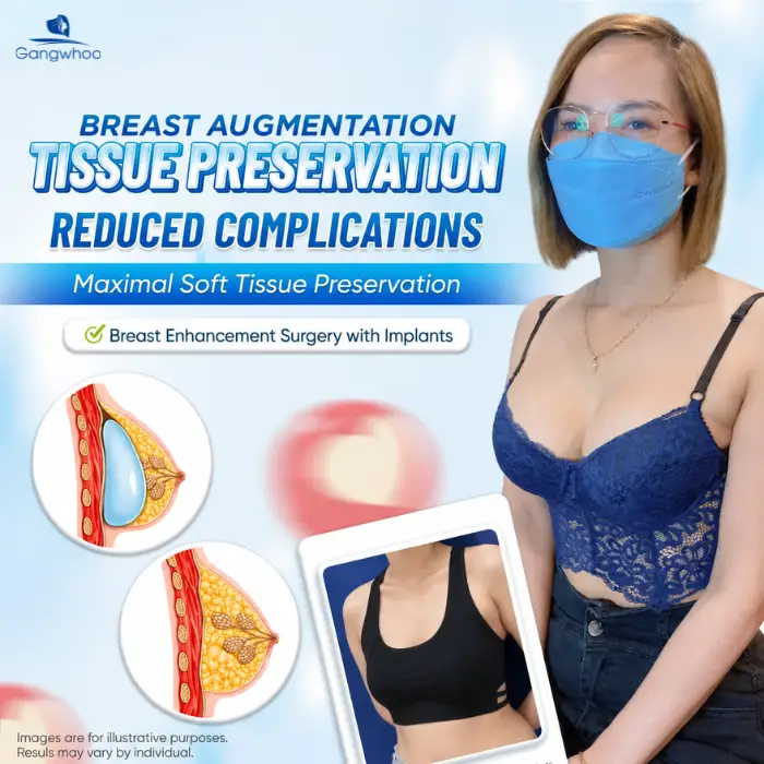 breast augmentation with tissue preservation 1 1