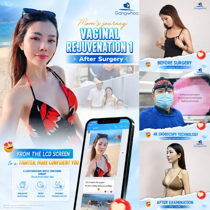 breast augmentation with tissue preservation 2 1