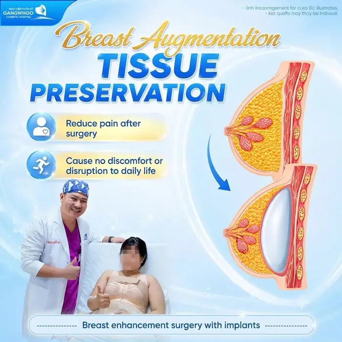 Tissue Preservation Breast Augmentation minimizes postoperative discomfort and has less impact on daily activities