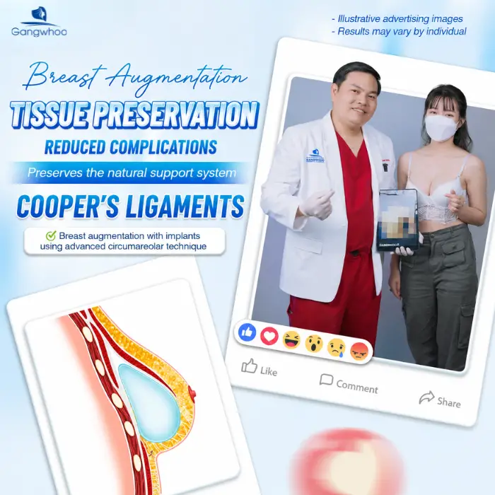 breast augmentation with tissue preservation 4 1