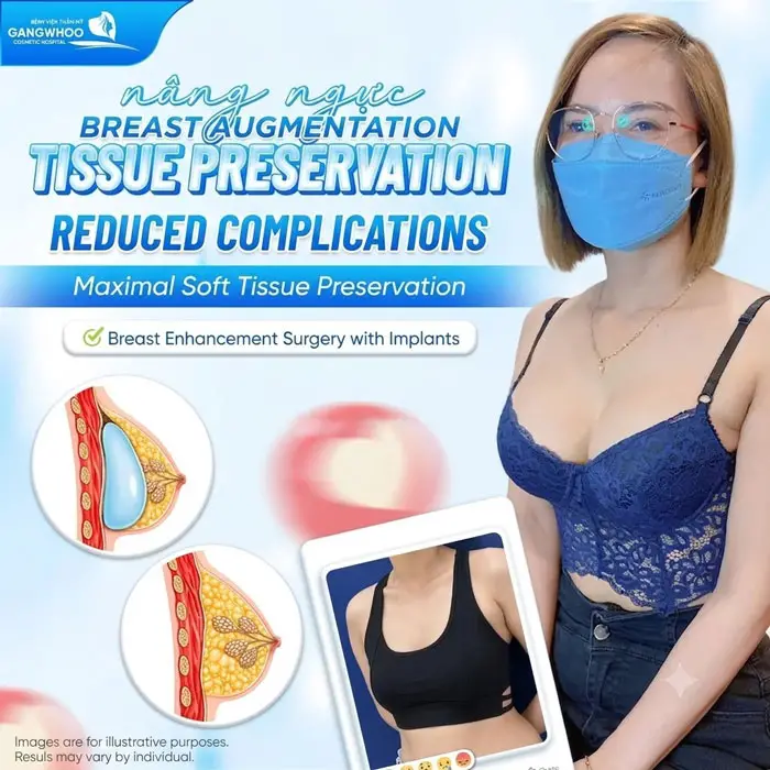 Tissue Preservation Breast Augmentation minimizes complications while preserving the soft tissue structure to the greatest extent possible