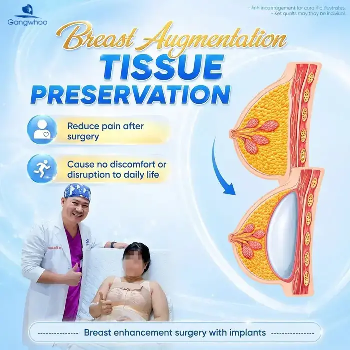 breast augmentation with tissue preservation 5 1