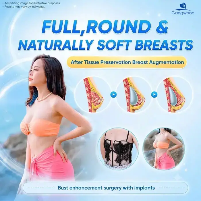 breast augmentation with tissue preservation 6 1